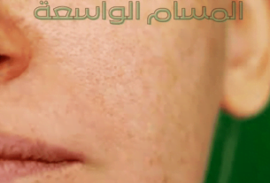 المسام الواسعة