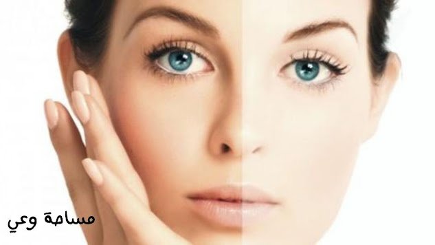 تفتيح البشرة طبيعيا خلال أسبوع واحد