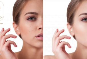 علاج المسامات الواسعة