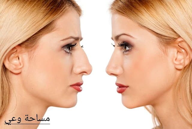 عملية تصغير الانف