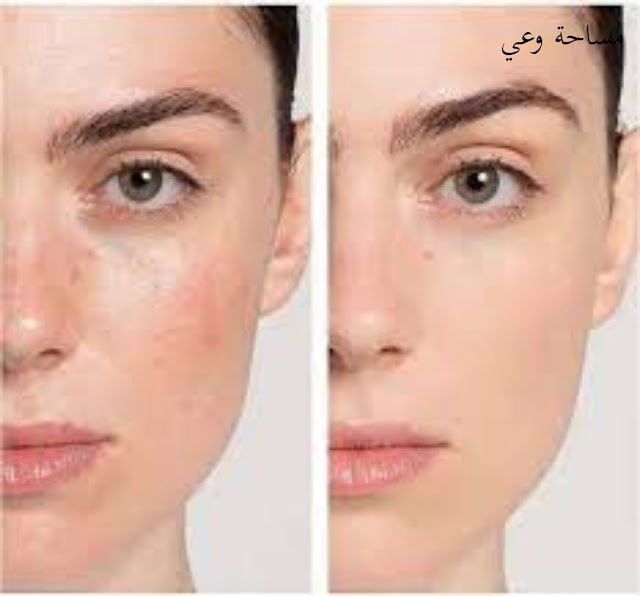 فوائد البرايمر الشفاف، وطريقة تطبيقه على البشرة دون أخطاء