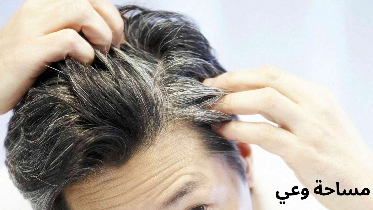 فيتامينات لمنع ظهور الشيب