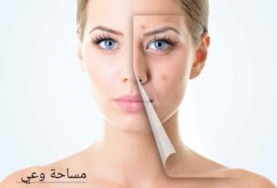 طرق تصفية الوجه من آثار حب الشباب