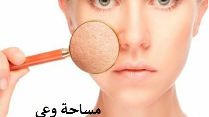  علاج المسام الواسعة للبشرة الدهنية