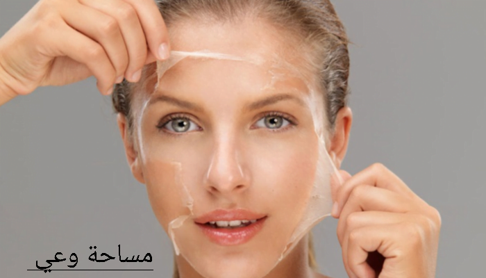 أسرع علاج للكلف