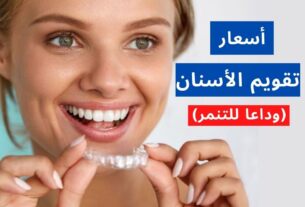 أسعار تقويم الأسنان