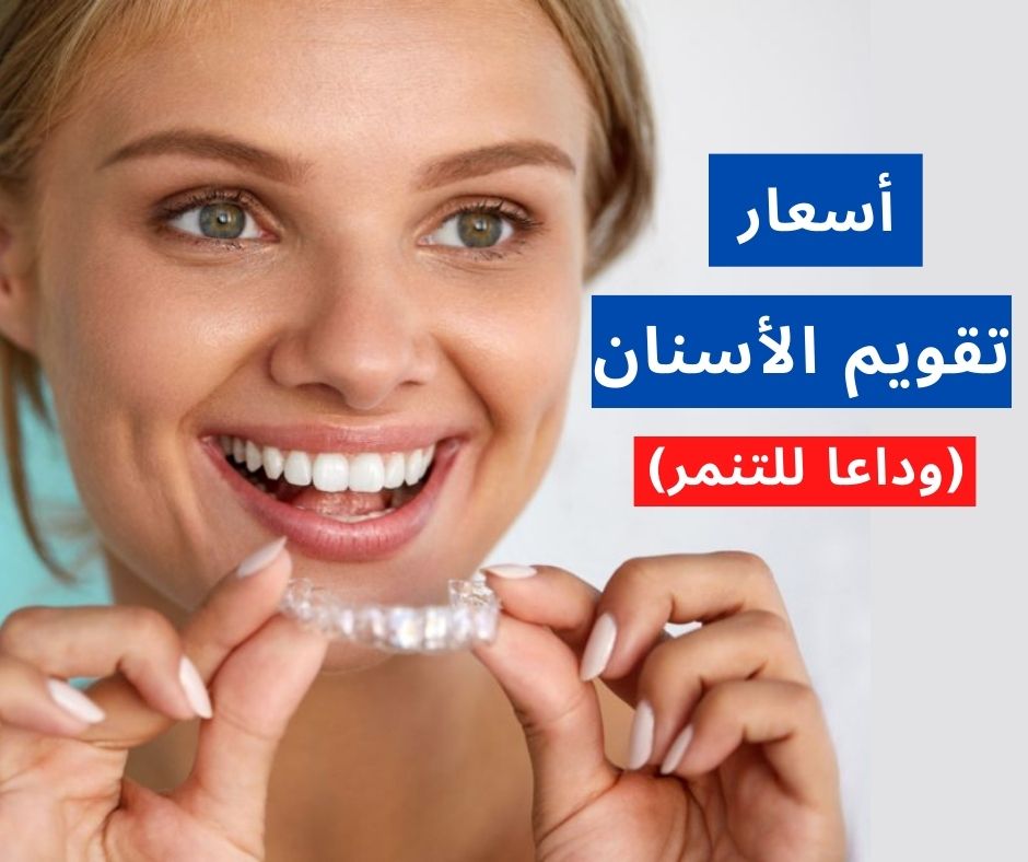 أسعار تقويم الأسنان موقع مساحة وعي 