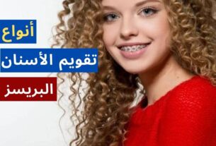 أنواع تقويم الأسنان كل ما تود معرفته عن البريسز