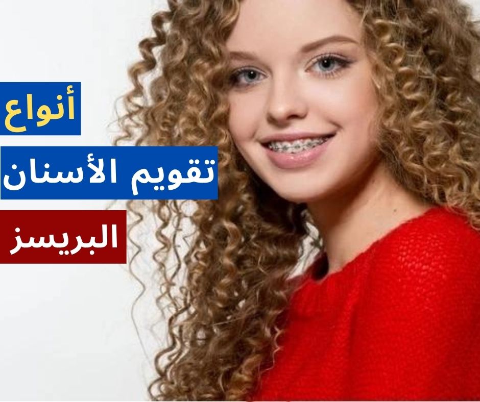 أنواع تقويم الأسنان كل ما تود معرفته عن البريسز