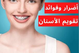اضرار تقويم الاسنان وفوائده