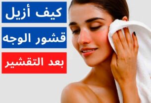 كيف أزيل قشور الوجه بعد التقشير