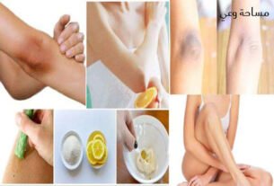 كيف اتخلص من سواد الركب والاكواع