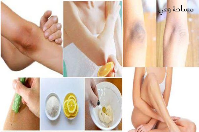 كيف اتخلص من سواد الركب والاكواع