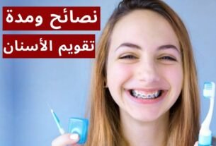 مدة تقويم الأسنان ونصائح لاجتياز هذه الفترة بنجاح