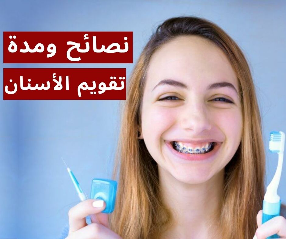 مدة تقويم الأسنان ونصائح لاجتياز هذه الفترة بنجاح