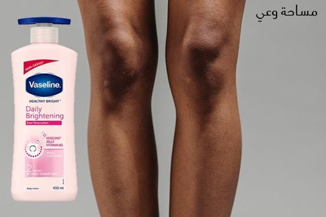 هل الفازلين يسود الركب