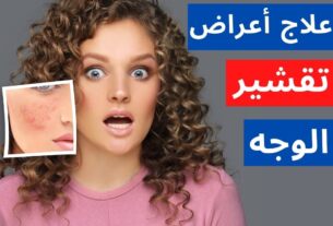 طريقة علاج تقشير الوجه