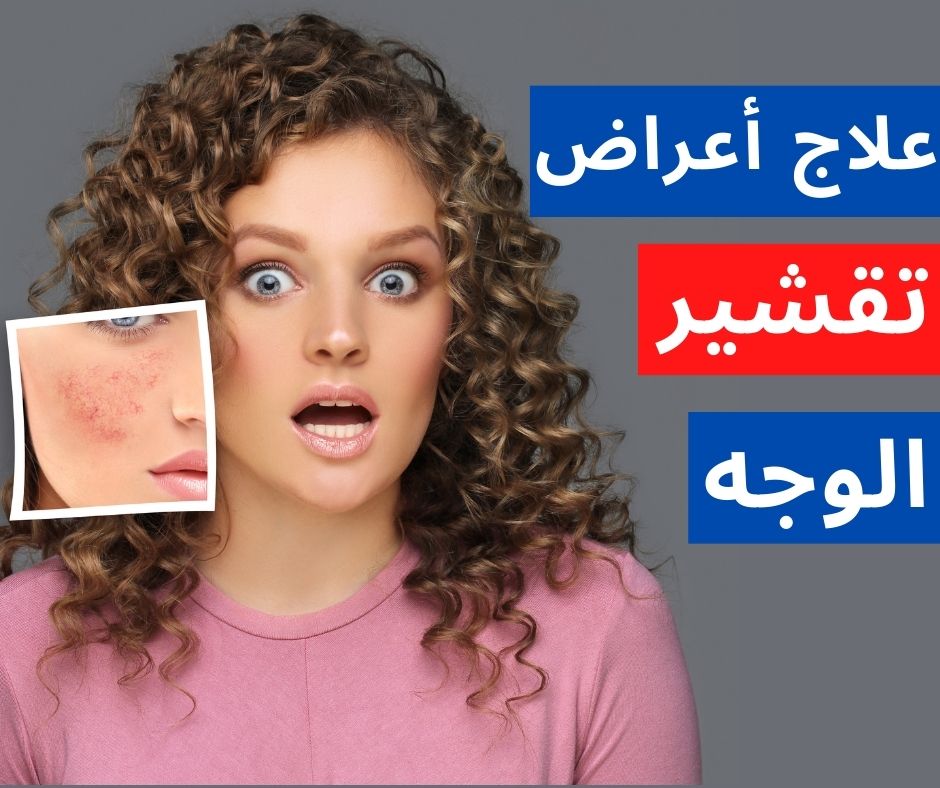 طريقة علاج تقشير الوجه