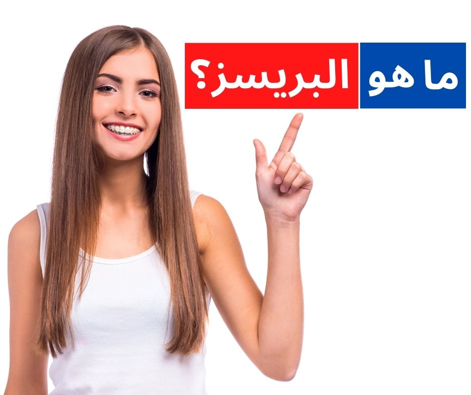 البريسز ما هو