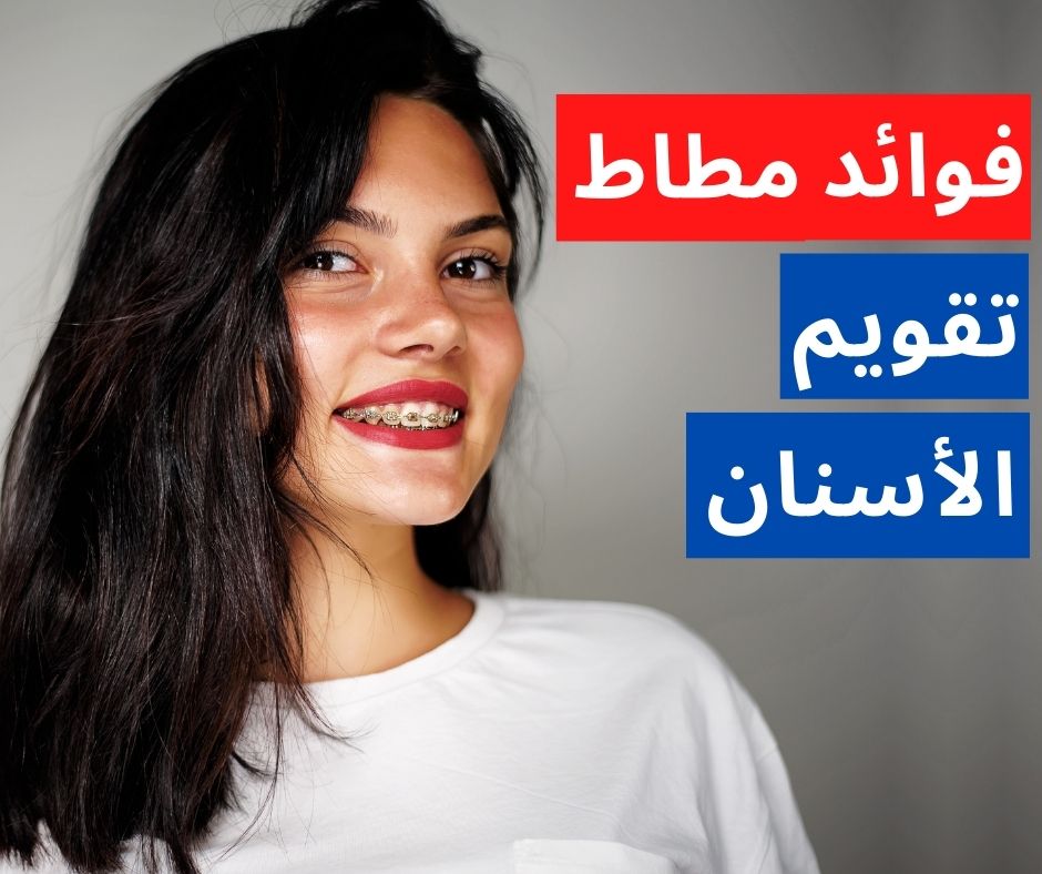 مطاط تقويم الأسنان