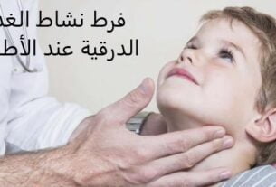 فرط نشاط الغدة الدرقية عند الأطفال