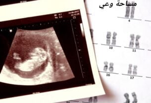 أسباب متلازمة داون أثناء الحمل 