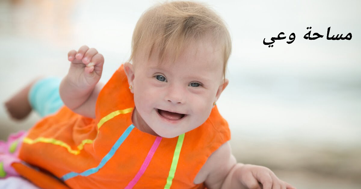 أسباب وأعراض متلازمة داون