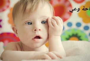 كم يعيش مريض متلازمة داون؟