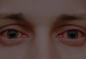 أعراض الرمد الربيعي