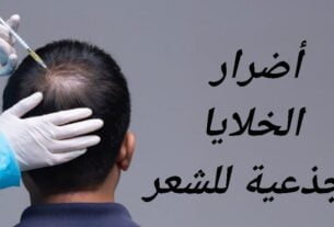 اضرار الخلايا الجذعية للشعر