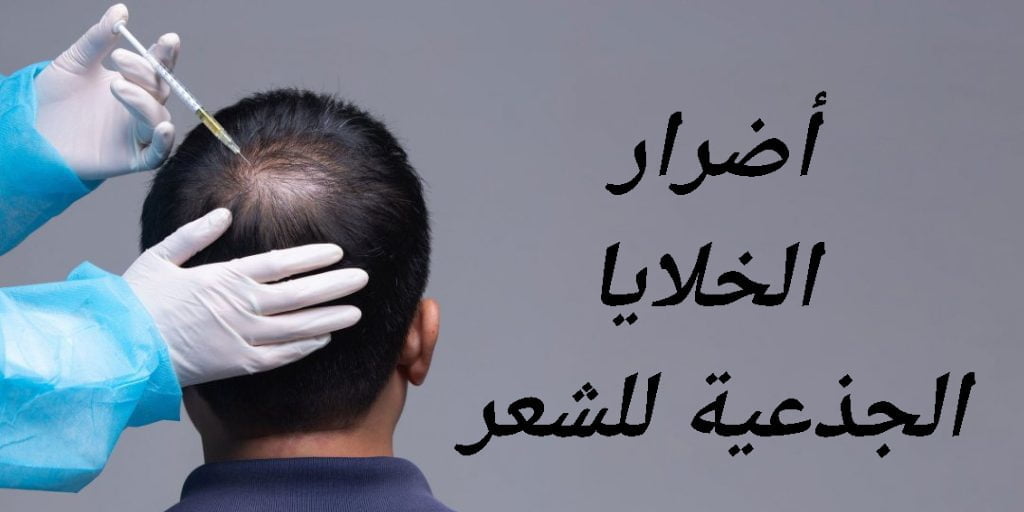 اضرار الخلايا الجذعية للشعر