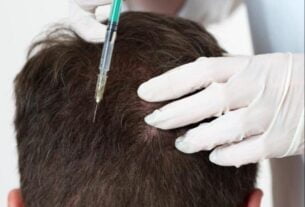 سعر الخلايا الجذعية للشعر