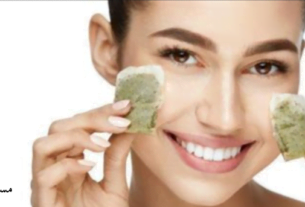 علاج الرمد الربيعي بالشاي