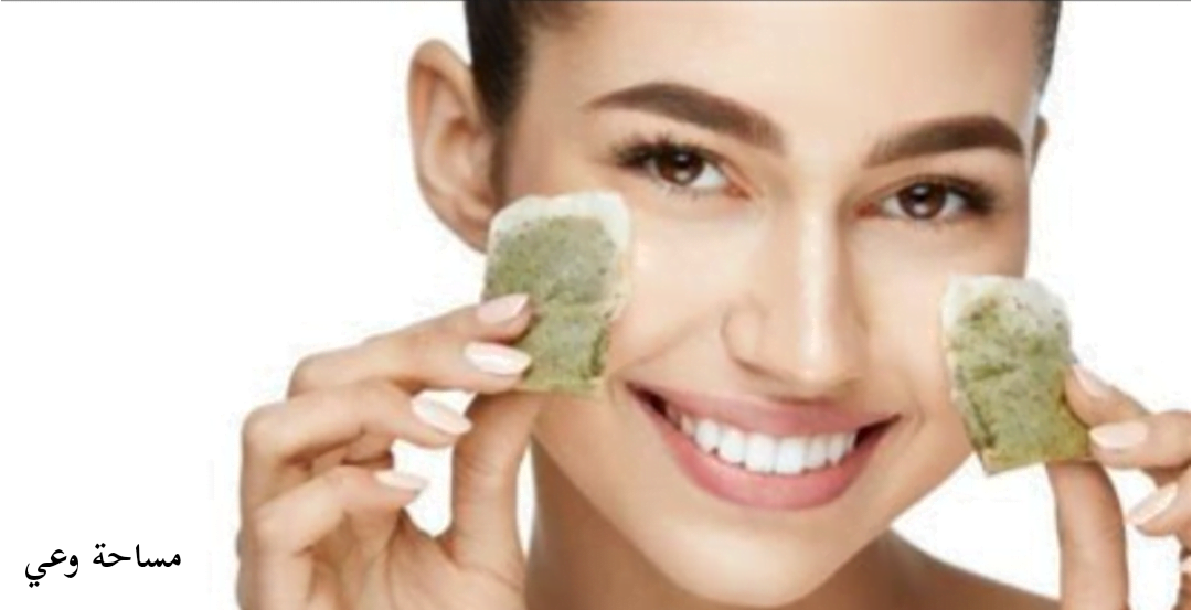 علاج الرمد الربيعي بالشاي