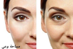 سعر الميزوثيرابي للوجه 2023