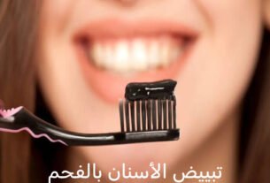 تبييض الأسنان بالفحم