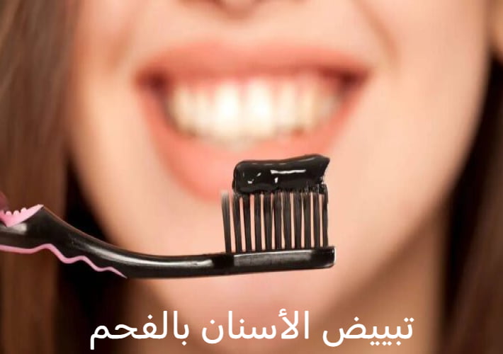 تبييض الأسنان بالفحم